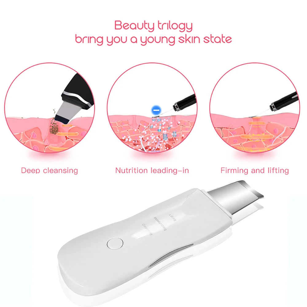 Espátula Ultrassônica Facial — Limpeza Profunda e Esfoliação