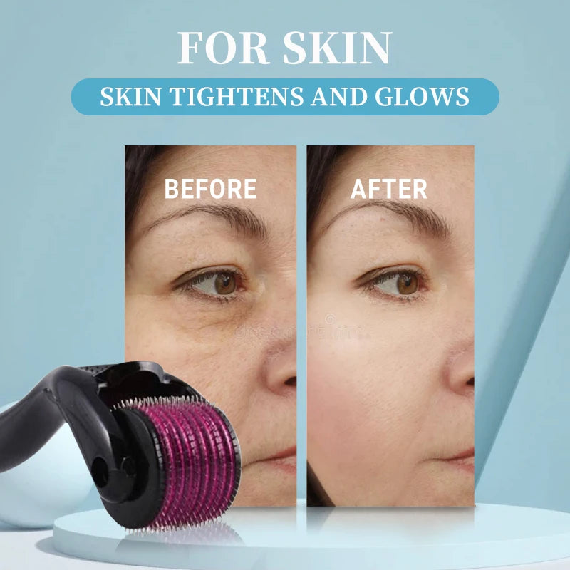 Derma Roller 540 Titanium — Microagulhamento para Skincare e Couro Cabeludo